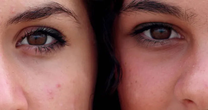 Time to take a good look at your eye health